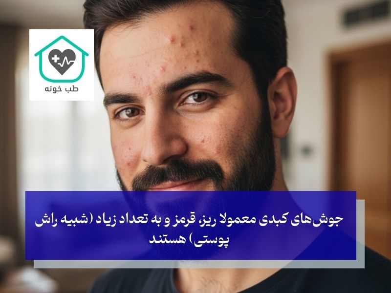 جوش‌های کبدی چه شکلی هستند