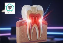 درد دندان پر شده