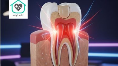 درد دندان پر شده