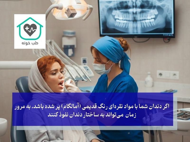 راز تیرگی دندان‌های ترمیم‌شده