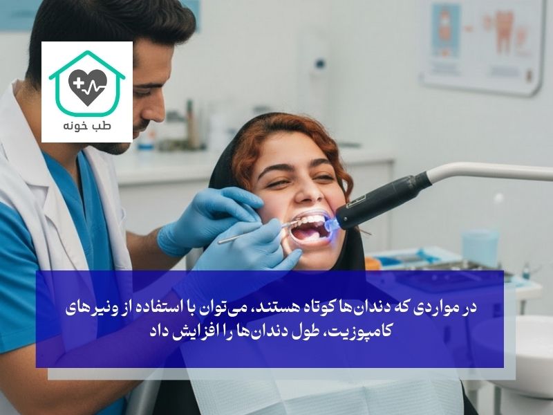 روکش‌های دندانی (لمینت یا کامپوزیت)؛ یک راهکار ترکیبی