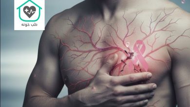 سرطان سینه در مردان