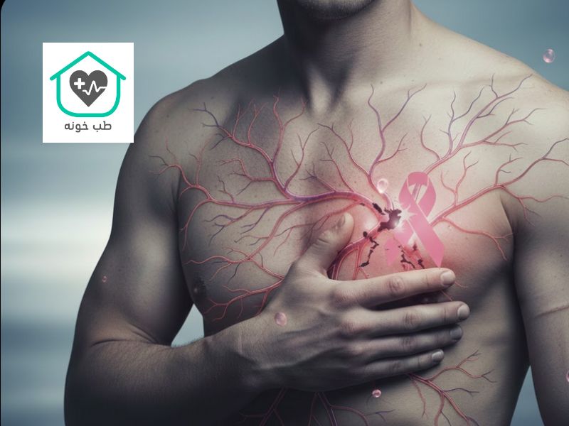 سرطان سینه در مردان