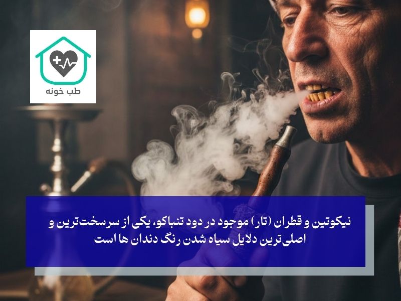 دلایل سیاه شدن رنگ دندان ها