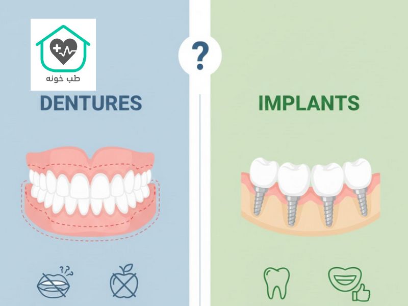 فرق اوردنچر با ایمپلنت