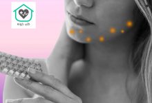 قرص برای جوش هورمونی
