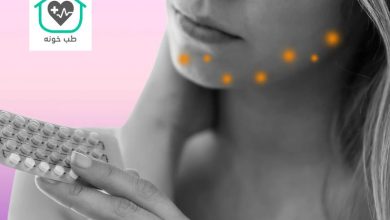 قرص برای جوش هورمونی