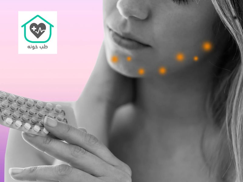 قرص برای جوش هورمونی