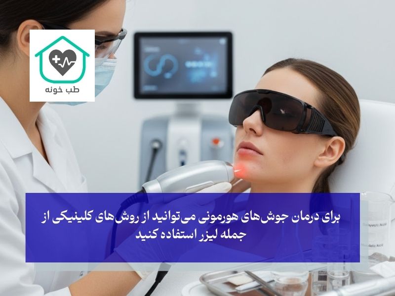 قوی‌ترین روش‌های کلینیکی درمان جوش های هورمونی