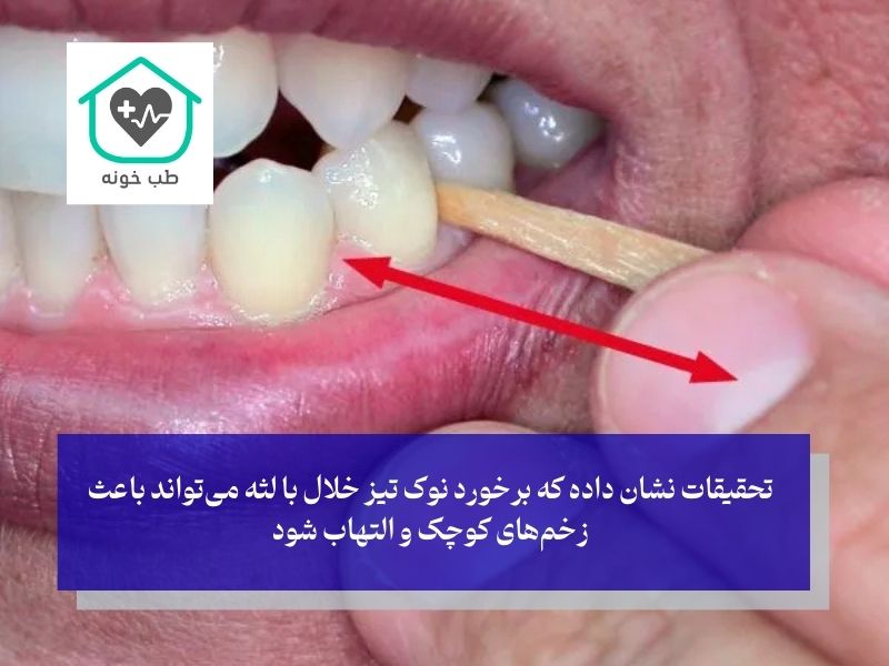 مضرات خلال دندان