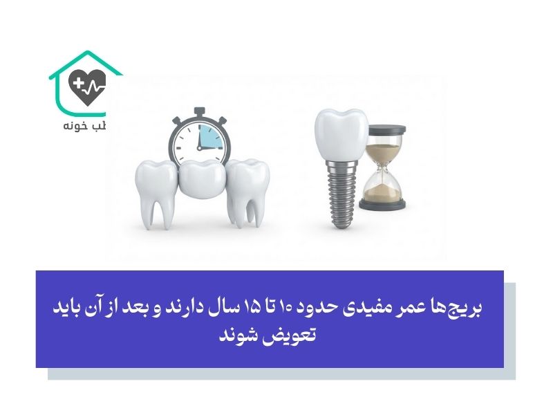 پول شما کجا بهتر خرج می‌شود؛ ایمپلنت یا بریج؟