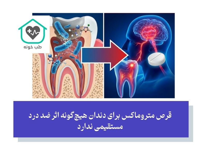 چرا متروماکس مسکن نیست؟