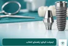 ایمپلنت کرهای و قطعات آن