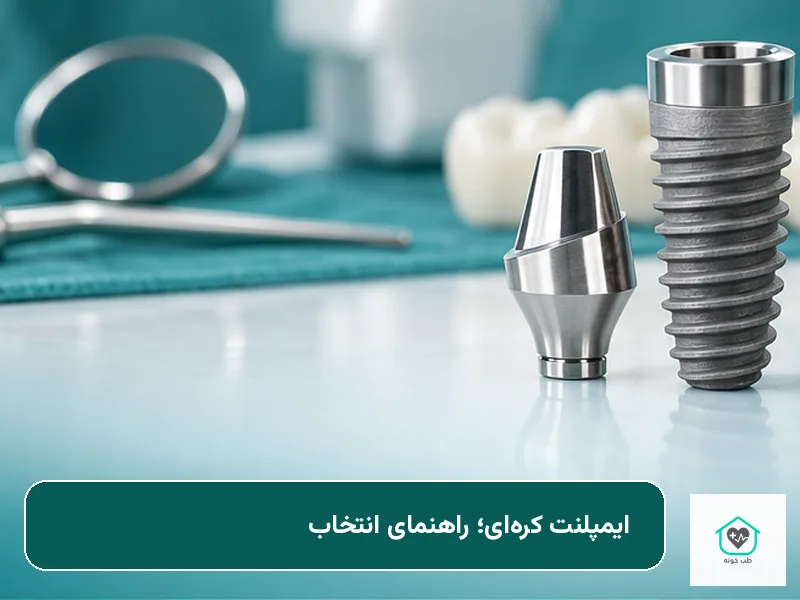 ایمپلنت کرهای و قطعات آن