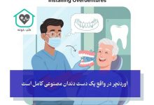 مینی ایمپلنت و کاربرد آن برای ثابت کردن پروتز و دندان مصنوعی