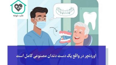 مینی ایمپلنت و کاربرد آن برای ثابت کردن پروتز و دندان مصنوعی