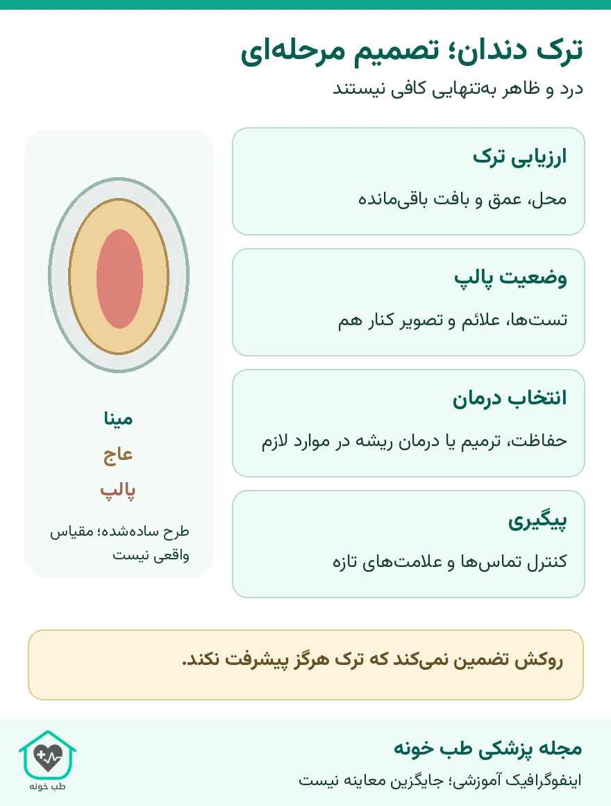 ترک دندان؛ تصمیم مرحلهای؛ درد و ظاهر بهتنهایی کافی نیستند
